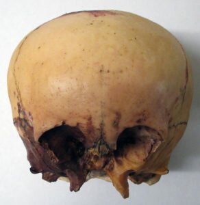 Star skull cast front view
