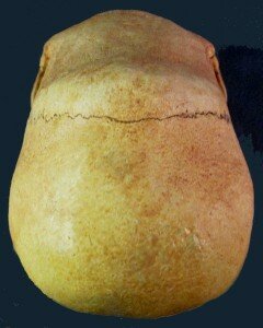 Top of skull from rear view shows no visible suture between two halves of parietal and no suture between two halves of frontal
