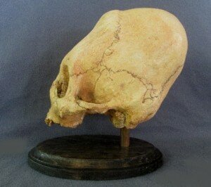 Left side