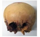 Star skull cast front view