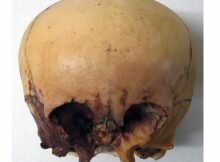 Star skull cast front view
